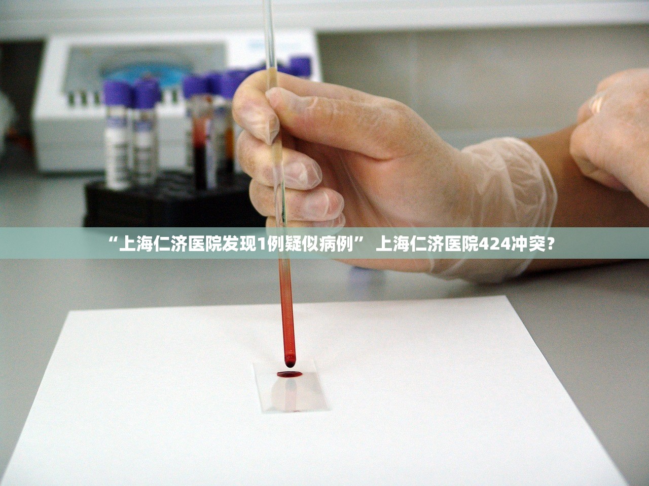 “上海仁济医院发现1例疑似病例	” 上海仁济医院424冲突？