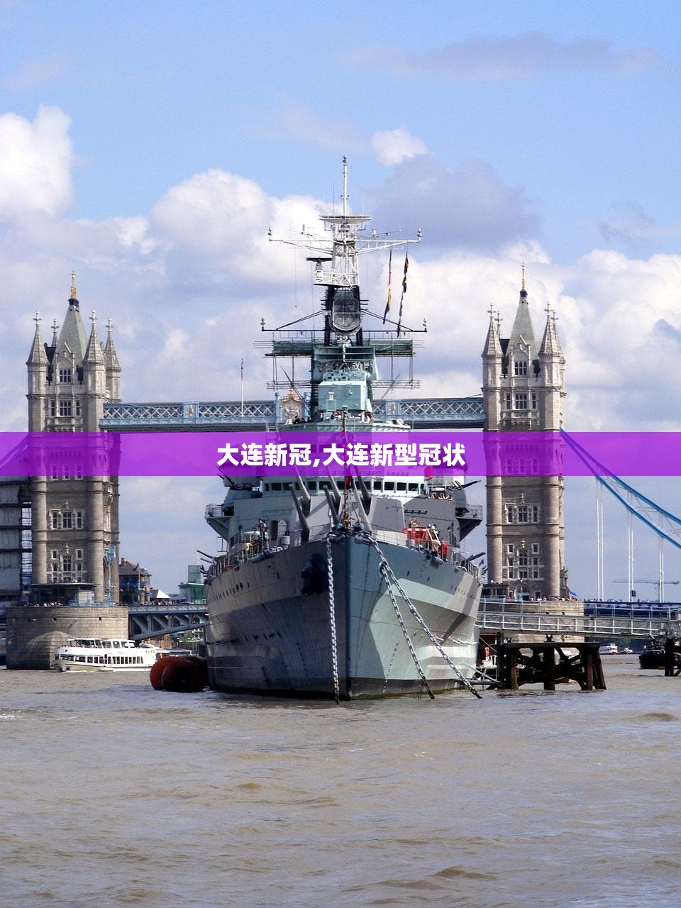 大连新冠,大连新型冠状