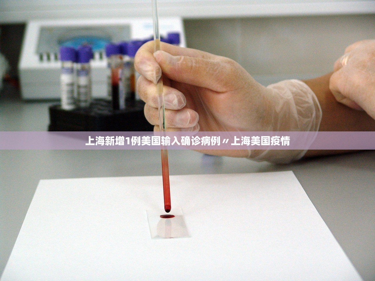 上海新增1例美国输入确诊病例〃上海美国疫情